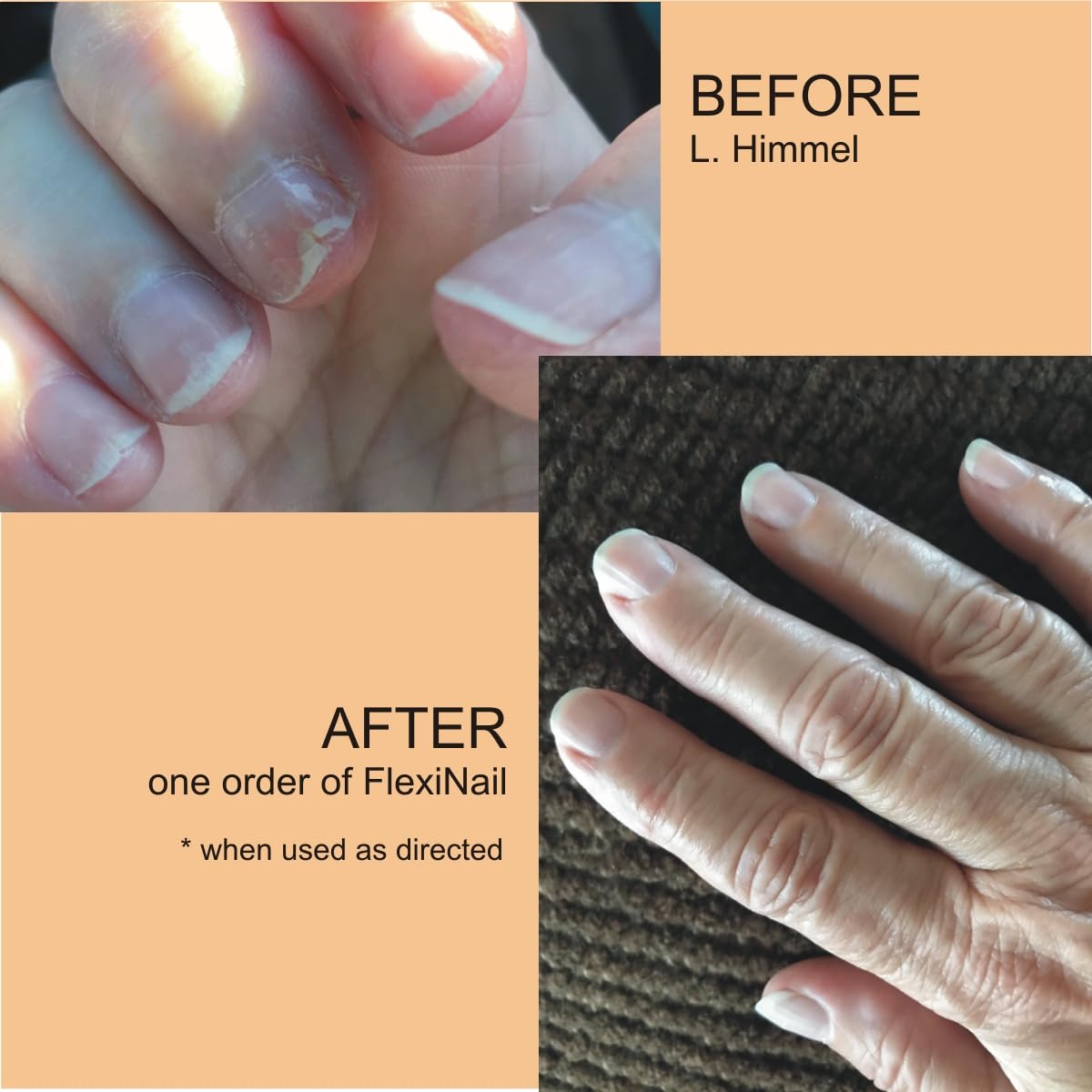 Penetrating Fingernail Conditioner and Strengthener to repair and then maintain weak and peeling or brittle and splitting nails