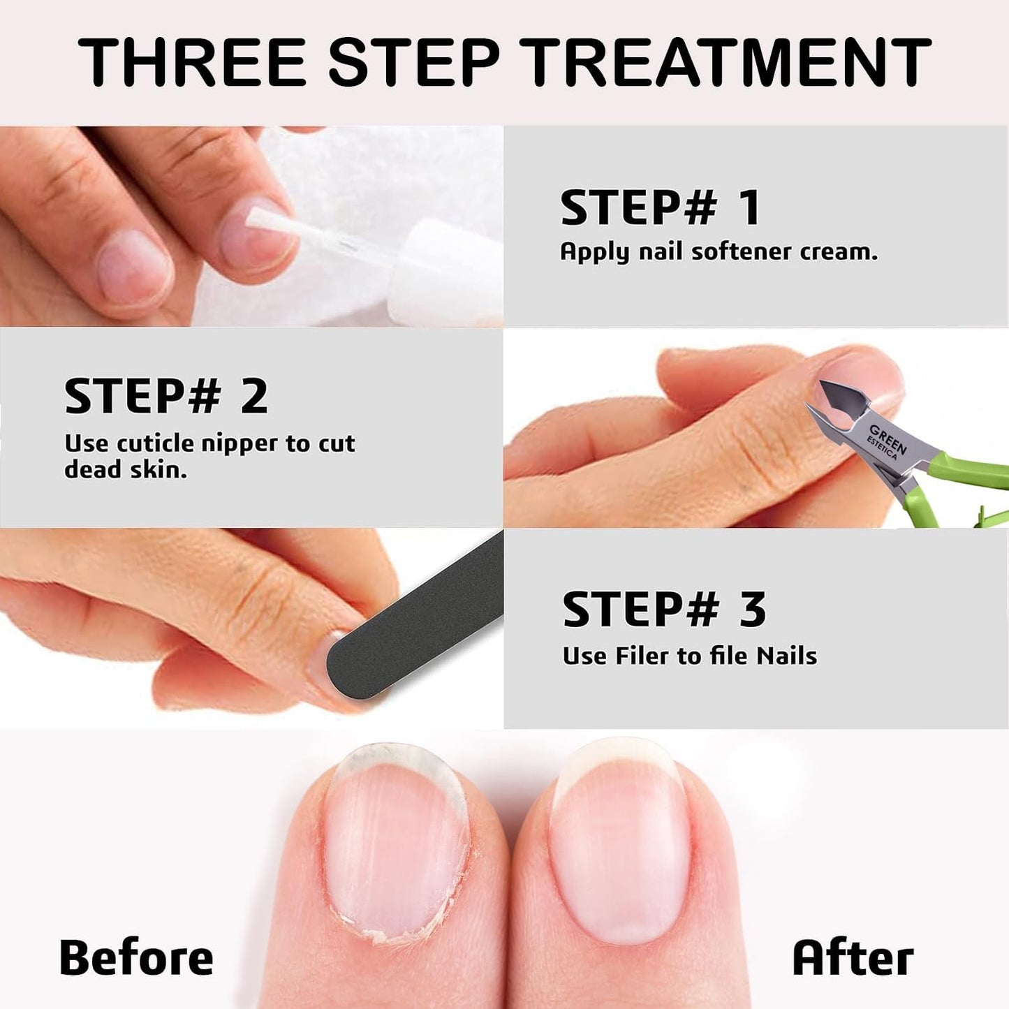 Professional Cuticle Trimmer Nail Cuticle Cutter Stainless Steel Cuticle Nippers with Sharp Blades of Cuticle Remover Clippers Manicure Tools Double Spring - Pedicure Nail Tools (Multi Color - 4 Pack)