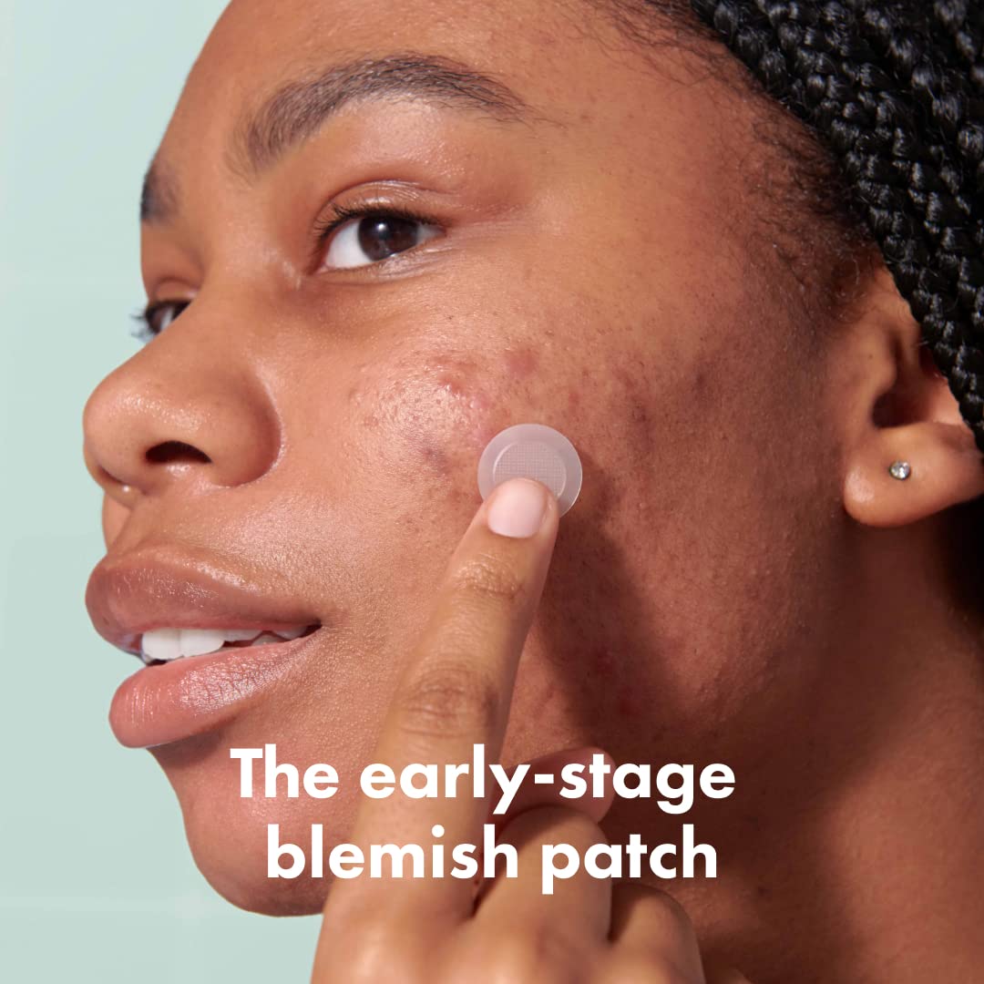 Mighty Patch Micropoint Large Hydrocolloid Pimple Patches for Face Blemishes from Hero Cosmetics, Acne Stickers for Early Stage Zits & Hidden Pimples, 395 Proprietary Micropoints, 8 Count