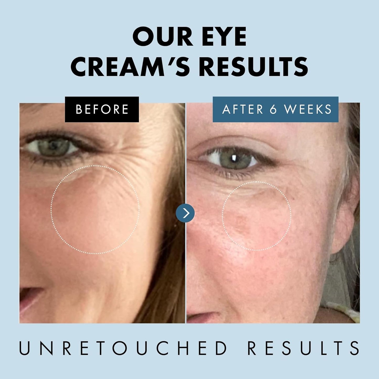 Eclat Skincare Under Eye Cream for Dark Circles and Puffiness - Eye Repair Cream Dark Circles Under Eye Treatment - Eye Cream Anti Aging Under Eye Serum Moisturizer Puffy Eyes Treatment Dark Circle