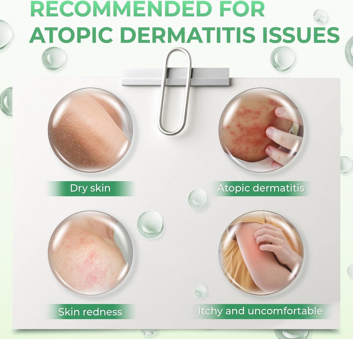 Atoskin Shower Gel (3 Pack) - for Eczema, Psoriasis, Dermatitis, and Anti-Itch Relief - Maximum Strength for Both Kids and Adults (20.4 oz)