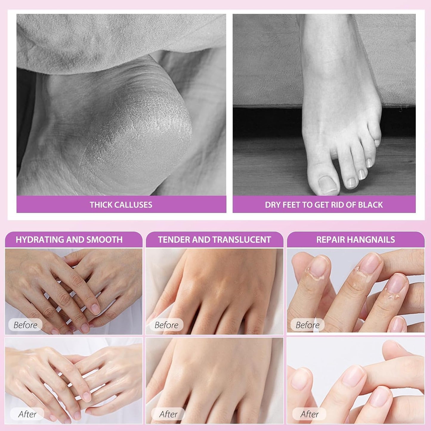 Hydrating Hand Foot Masks Set,3 Pack Glove Mask for Dry Hand,Exofliating 3 Pack Socks Maskfor Peeling Away Dead Skin Calluses（Lavender）