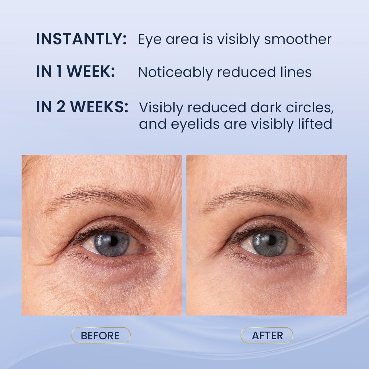 Dual Eye Cream with Advanced Retinol, Peptides, Caffeine for Puffy Eyes and Dark Circles, Wrinkles, Anti Aging, Under Eye Bags Treatment, Instant Tightener, Fragrance Free, 0.68 OZ