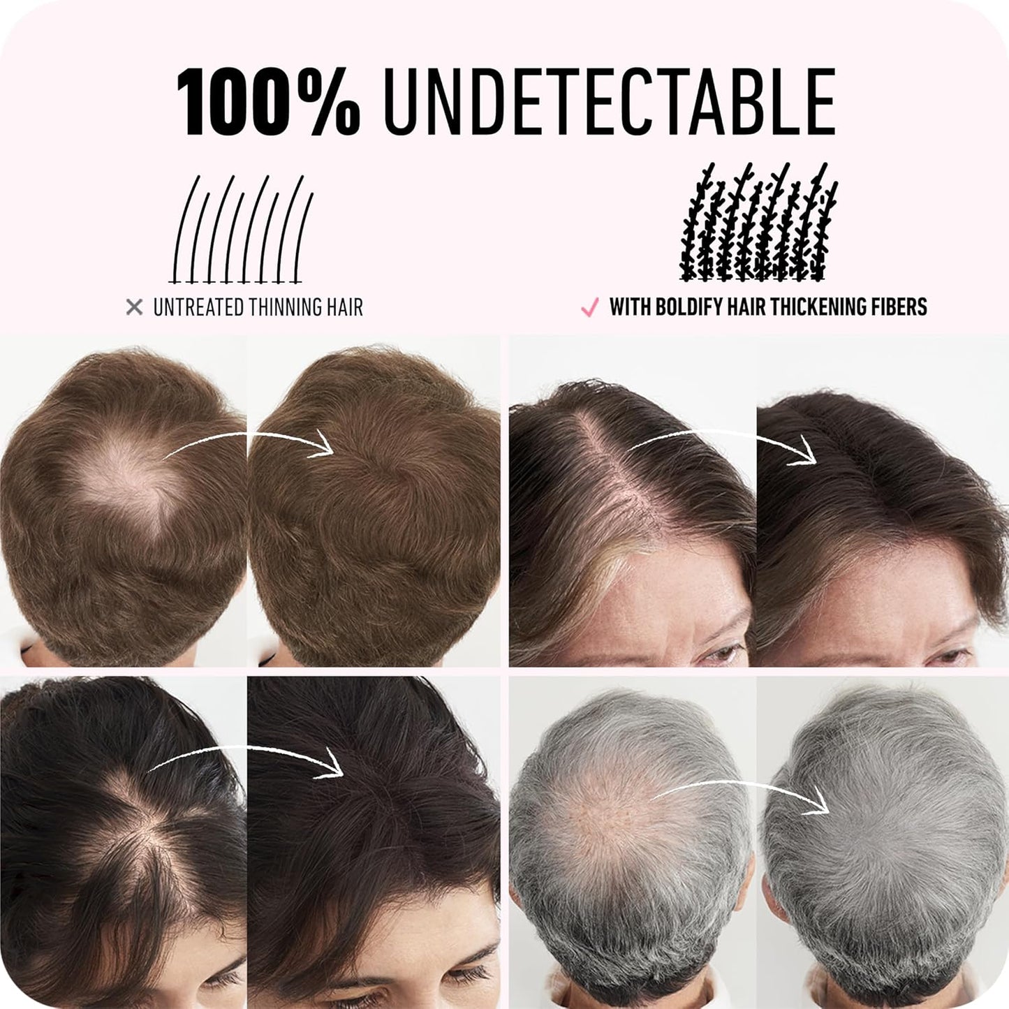 BOLDIFY Hair Fibers (28g) - Fill In Thinning and Fine Hair for an Instantly Fuller, Thicker Look - 14 Shades for Women & Men - Hazel Brown