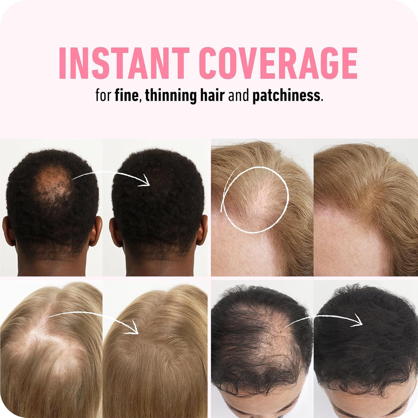 BOLDIFY Hair Fibers (56g) - Fill In Thinning and Fine Hair for an Instantly Fuller, Thicker Look - 14 Shades for Women & Men - Medium Blonde