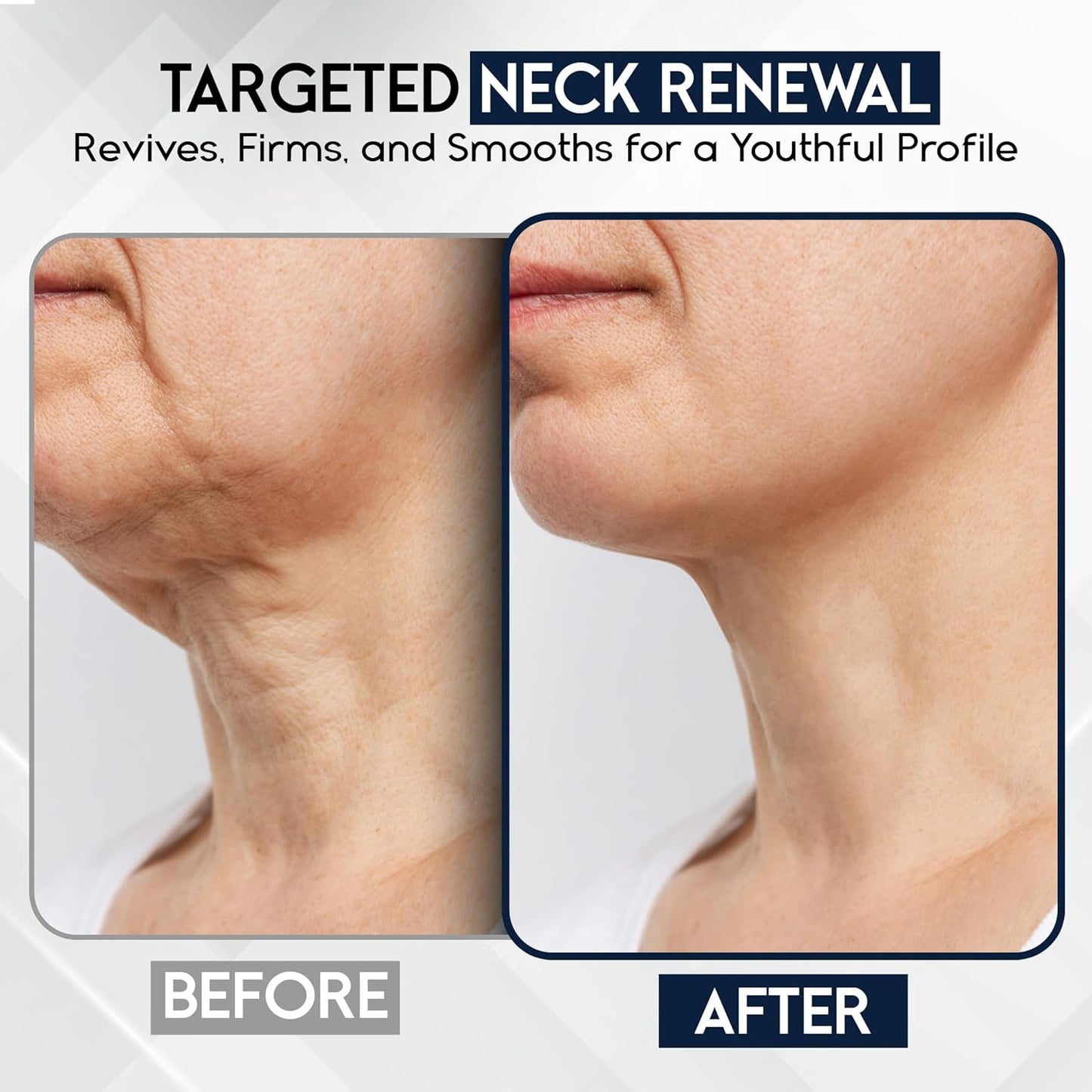 Neck Creams for Tightening and Firming Sagging Skin - Skin Tightening Cream for Face - Decollete & Chest, Under Chin Firming for Older Women - Neck Wrinkles Treatment with Collagen & Hyaluronic Acid