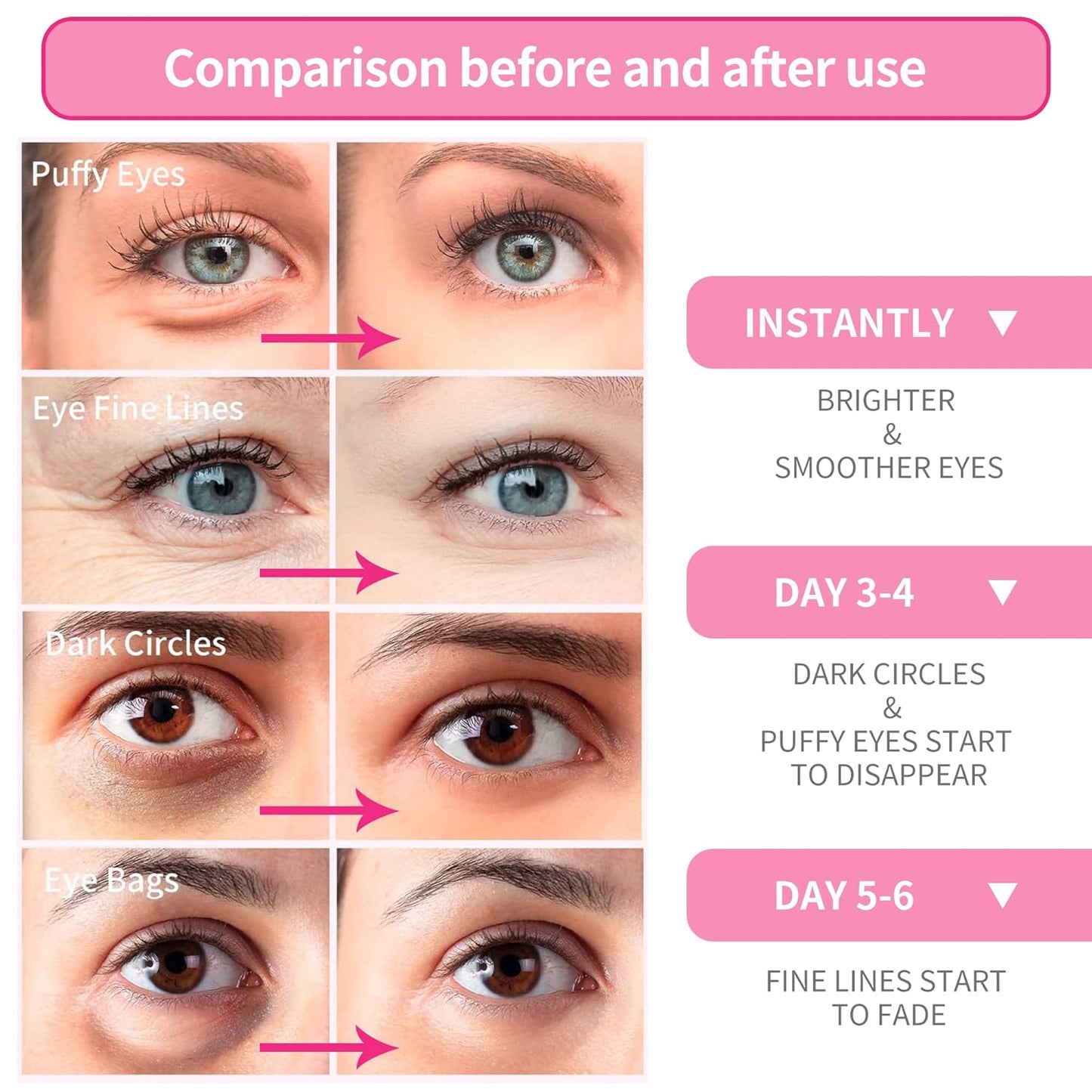 BREYLEE Rose Eye Mask– 60 Pcs - Eye Treatment Mask, Under Eye Bags Treatment, Under Eye Masks for Puffy Eyes, Anti-Aging,Anti-Wrinkle and Fine Lines, Under eye Dark Circles