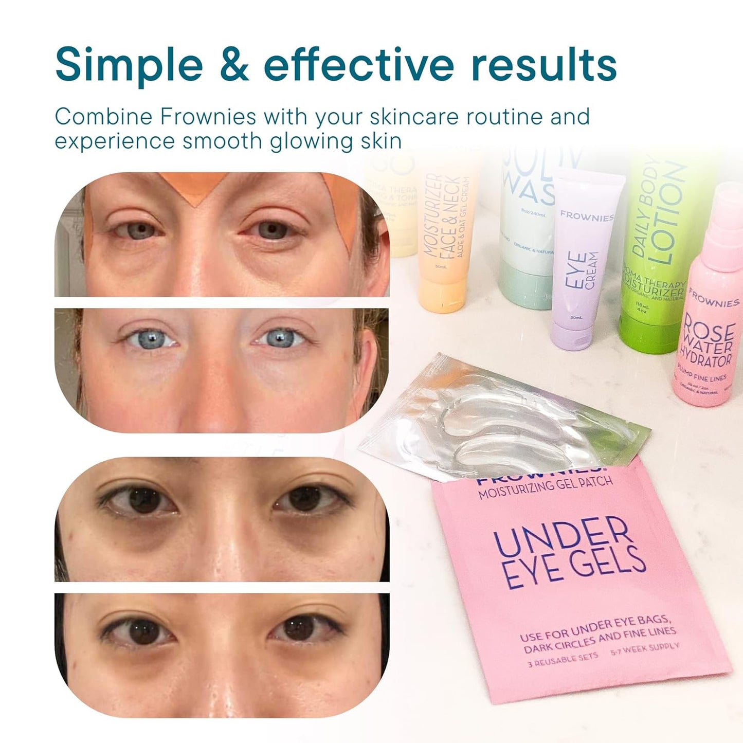 Frownies Under Eye Gel Patches for Puffy Eyes - Under Eye Patches for Dark Circles with Cactus Collagen - Under Eye Mask for Dark Circles and Puffiness - Reusable, 3 Pack